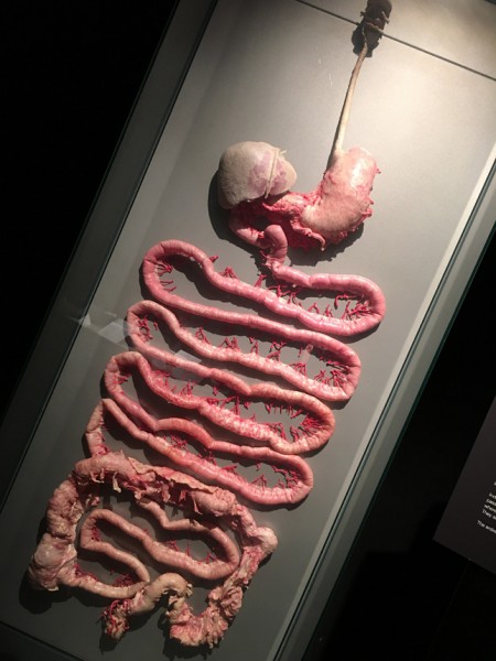 bodyworlds_intestines